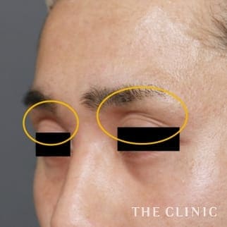 【THE CLINIC 症例画像】No.846_1