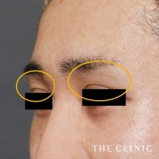 【THE CLINIC 症例画像】No.846_2