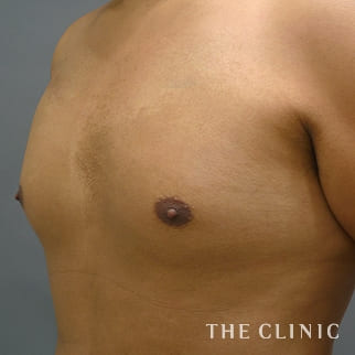 【THE CLINIC 症例画像】No.873_1