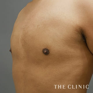 【THE CLINIC 症例画像】No.873_2