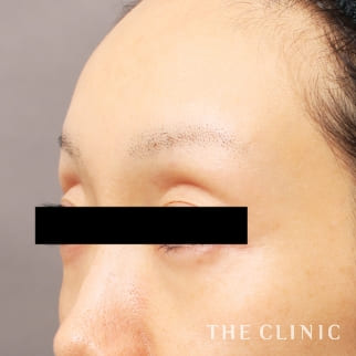 【THE CLINIC 症例画像】No.942_1