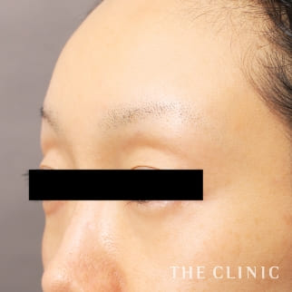 【THE CLINIC 症例画像】No.942_2