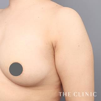 【THE CLINIC 症例画像】No.950_2