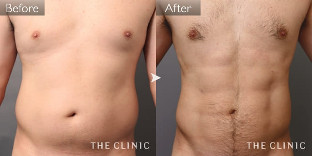 腰・ウエスト(男性/31歳)