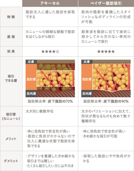 アキーセル脂肪吸引の施術3