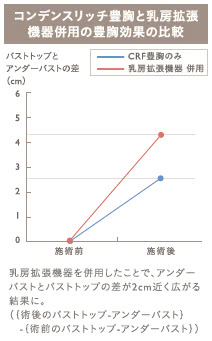 コンデンスビブラ豊胸の施術2
