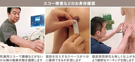 豊胸カウンセリングの施術5