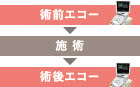 エコー検査の施術1