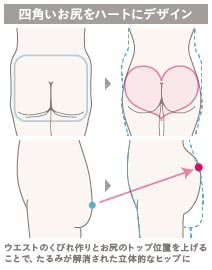 ハートヒップリフト(お尻の整形)の施術2