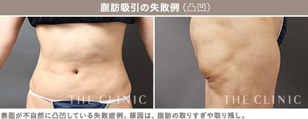 4Dマーキングシミュレーションの施術1