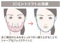 3Dミントリフト(糸のフェイスリフト)の施術2