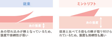 3Dミントリフト(糸のフェイスリフト)の施術1