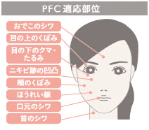 PFC注入(シワ・クマ解消)の施術3