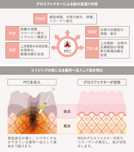 PFC注入(シワ・クマ解消)の施術2