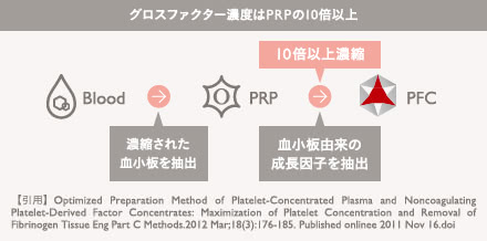 PFC注入(シワ・クマ解消)の施術3