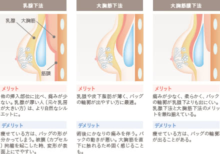 ソフトバイオセルバッグの施術2