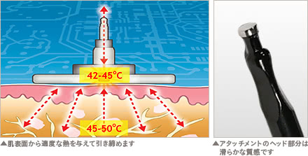 サーミ スムースの施術2