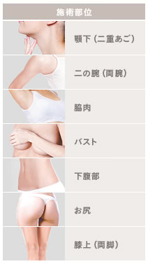 サーミタイト(たるみ改善)の施術2