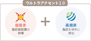 ウルトラアクセント2.0の施術1