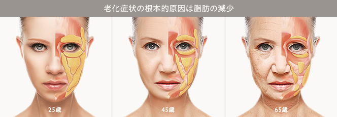 老化症状の根本的原因は脂肪の減少(25歳→45歳→65歳)