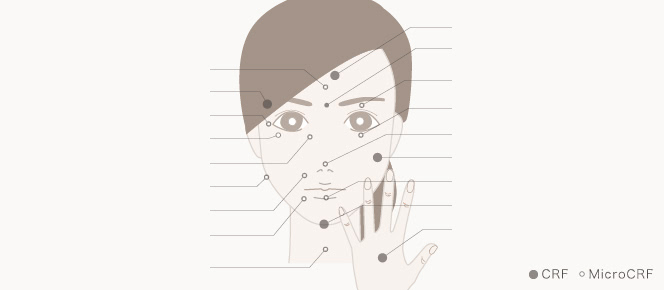 脂肪注入の適応部位