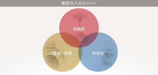 脂肪注入のメリット