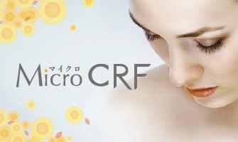 マイクロCRF