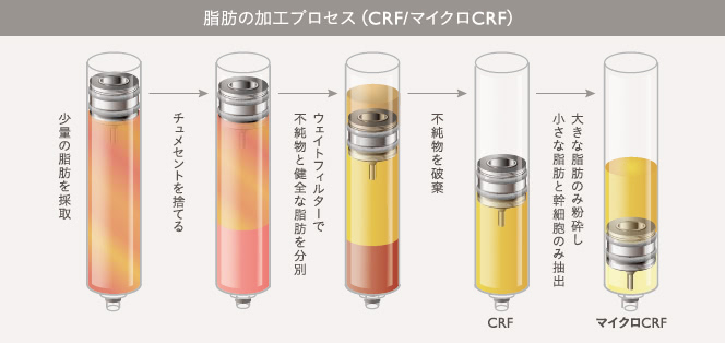 脂肪の加工プロセス（CRF/マイクロCRF）