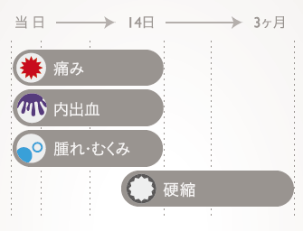 当日から14日: 痛み / 内出血 / 腫れ・むくみ | 14日から3ヶ月: 硬縮