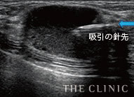 吸引中