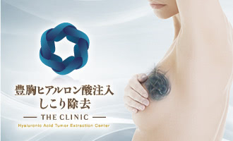 豊胸ヒアルロン酸注入しこり除去