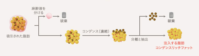 コンデンスリッチファット(CRF)の加工方法:①麻酔駅を分ける→②コンデンス濃縮→③分離と抽出→④完成