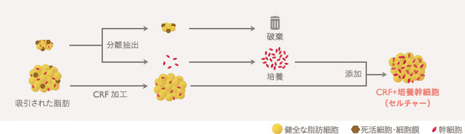 CRF+培養幹細胞(セルチャー)の加工方法:①脂肪から幹細胞を分離抽出→②培養→③CRFに添加→④完成
