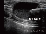 吸引中