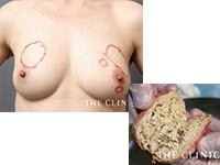 難易度の高い症例経験を応用