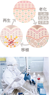 自分の細胞を活用した肌の治療 再生 / 老化 / 幹細胞注入