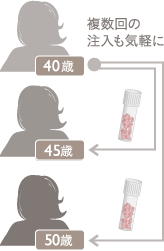複数回の注入も気軽に 例：40歳, 45歳, 50歳