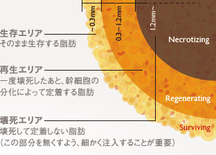 生存エリア: そのまま生存する脂肪 / 再生エリア: 一度壊死したあと、幹細胞の分化によって定着する脂肪 / 壊死エリア: 壊死して定着しない脂肪(この部分を無くすよう、細かく注入することが重要)
