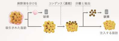 コンデンスリッチファット注入