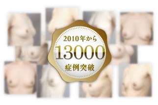 症例数は経験値です