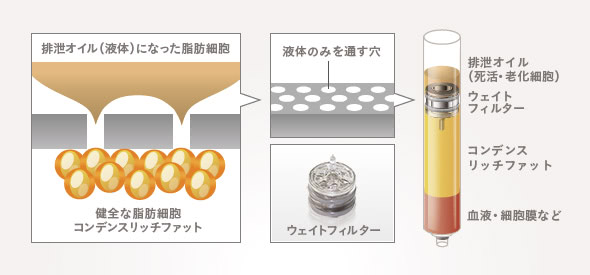 フィルタリング機能