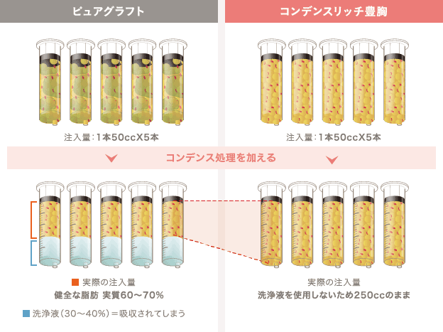 ピュアグラフト: 注入量:1本50ccX5本 / コンデンス処理を加える / 実際の注入量 健全な脂肪 実質60〜70% 洗浄液(30〜40%)=吸収されてしまう | コンデンスリッチ豊胸: 注入量:1本50ccX5本 / コンデンス処理を加える / 実際の注入量 洗浄液を使用しないため250ccのまま