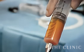 「LIPOMAX-SC」リポキットの使用により、外気に触れない状態で体内から脂肪を採取