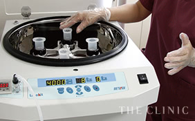 採取した脂肪を遠心分離機にかける