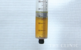 抽出したコンデンスリッチファット