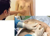 適正な注入量を判断