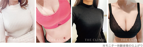 当モニター体験者様の仕上がり