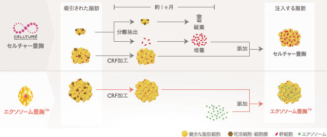 セルチャー豊胸とエクソソーム豊胸の比較