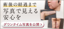 術後の経過まで写真で見える安心を ダウンタイム写真を公開