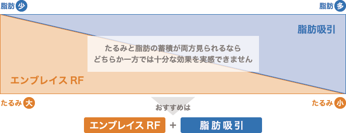 たるみと脂肪の蓄積が両方見られるならどちらか一方では十分な効果を実感できません おすすめはエンブレイスRF + 脂肪吸引